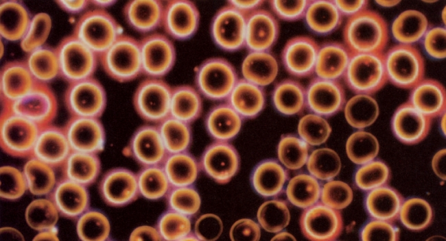 Eine Färbemethode zeigt gesunde rote Blutkörperchen mit nur wenigen harmlosen Pilz-Urformen.